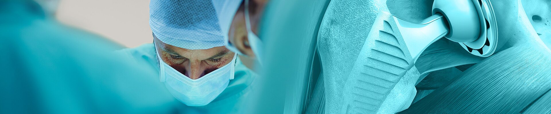 Chirurgischer Eingriff mit Implantation einer Hüftprothese – Symbol für moderne Endoprothetik und Gelenkersatz in der spezialisierten Orthopädie.